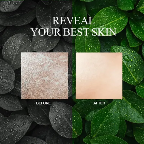 Guantes Exfoliantes Evridwear Para Ducha Con Mango Largo