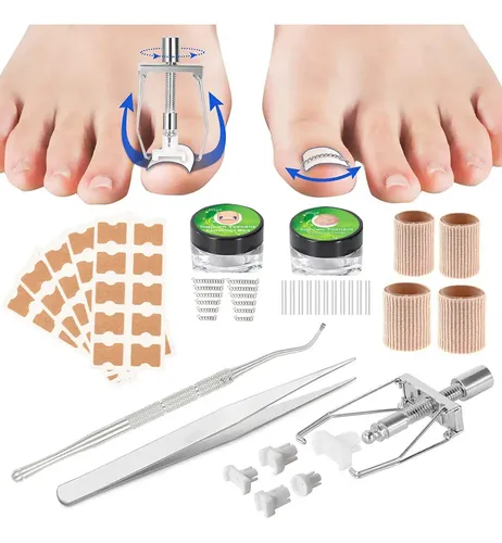 Set De Tratamiento Corrector De Uñas Encarnadas De Acero Ino