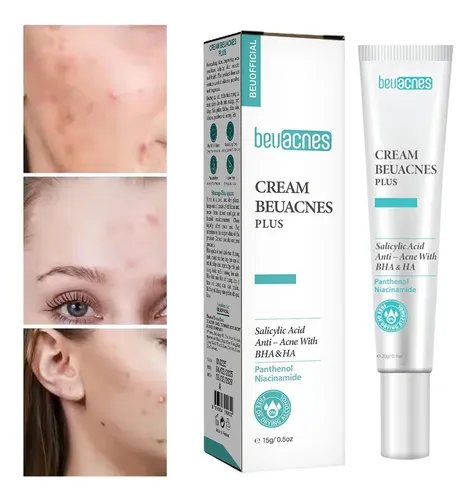 Crema Antiacné De Ácido Salicílico Para Aclarar Las Manchas