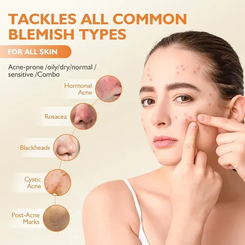 Tratamiento Acné Diurno Orgánico Con Arcilla Y Botanicals