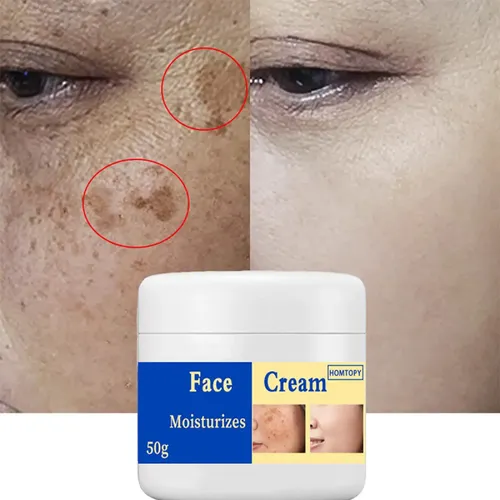 Crema Iluminadora Para Manchas Y Pigmentación