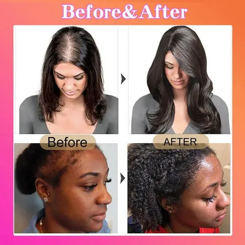 Aceite De Batana Dr Truth Para El Crecimiento Del Cabello