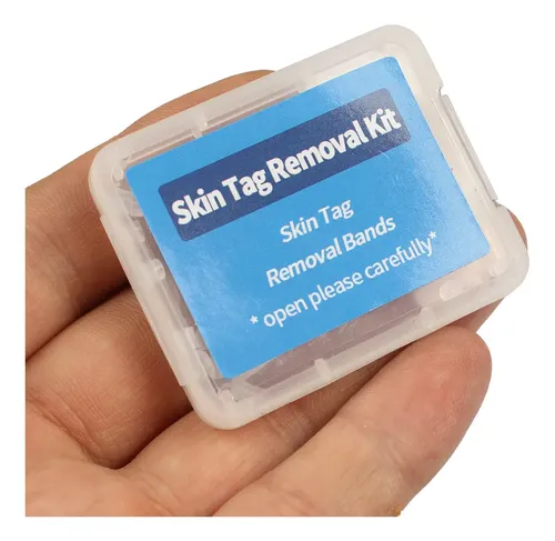 30pcs/box Flesh Non-toxic Removal Nevus Mole Bands  Ii No