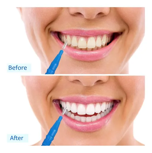 Bbto 100 Pcs Braces Del Persona Dental Flosser Para Cijo De