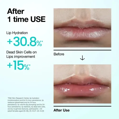Anua Pdrn Lip Serum Hidratante Reparador Labios
