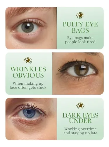 Adhesivo De Colágeno Para Ojos Con Aloe Vera Que Hidrata Y R