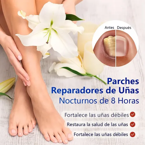 Zcommodity126 Parches De Uñas Con Hongos For Nepf0525pf 42