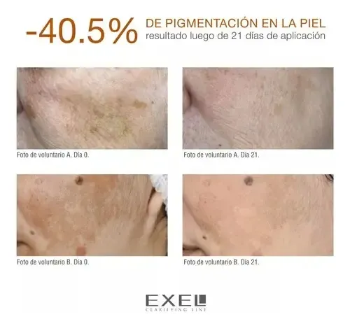 Exel Crema Clarificante Con Liposomas Aclarantes