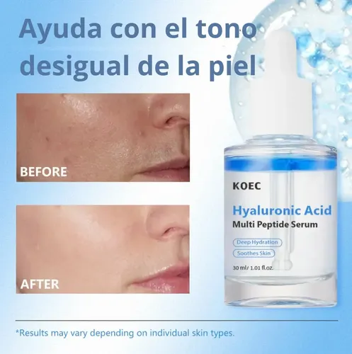 Serum Facial Ultra Hidratante Acido Hialuronico Koec Seca Día/noche