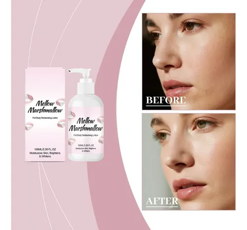 Zsset De Viaje De Loción Corporal Hidratante Para Citasss