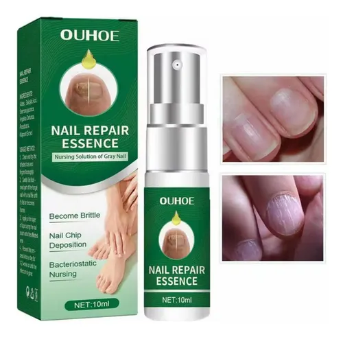 Suero Reparacion Uñas Ataca Hongos Onicomicosis Pies Manos