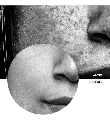 Revox Protector Solar Facial Spf50 + Ácido Hialurónico