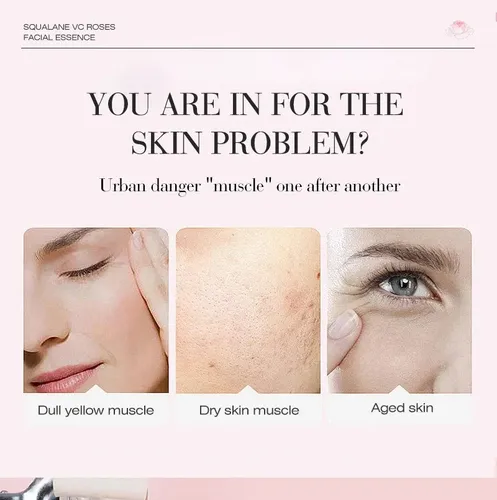Spring Tree Aceite Facial Y Corporal De Escualano