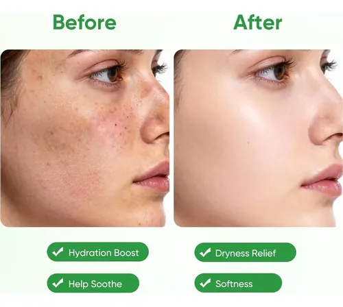 Mascarilla Facial Aloe Vera Hidratante 10 Unidades