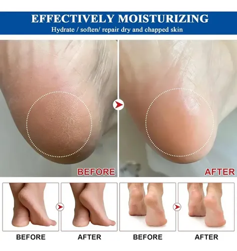 Crema Exfoliante Hidratante En Barra Para El Cuidado De Los