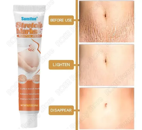 +crema Para Eliminar Estrías, Antiarrugas, Antienvejecimiento.