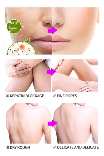 Exfoliante Corporal Yannameiji, Manteca De Karité, Loción Corpora