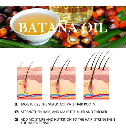 Aceite De Batana Discoliner Crecimiento Capilar 250ml