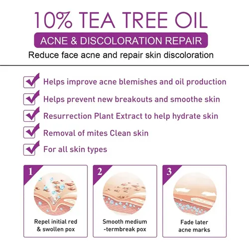 3 Unidades Crema Azelaica Un 10% Ácido Azelaico, C Acneica