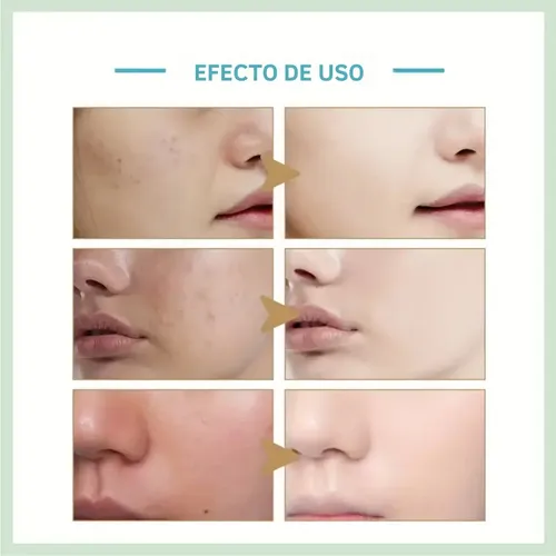 Spray Hidratante Facial, Tónico, Ácido Hialurónico, Aloe Ver