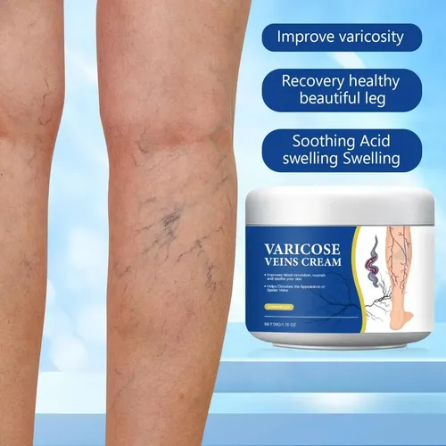 Crema Para Alivio De Várices Y Arañitas En Piernas 150g General