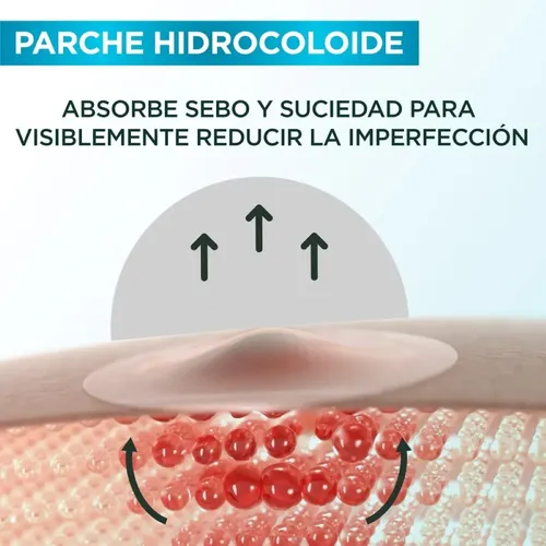 Parches Para Granos Anti Imperfecciones X22 Garnier