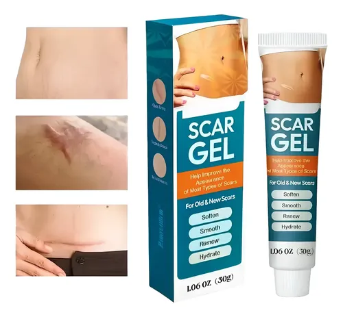 Gel Para Estrías Acné Cicatrices Quemaduras Y Puntos Negros