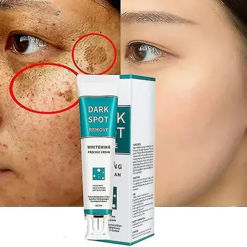 Tratamiento Laser Aclara Blanqueador Mancha Piel Zona Intima