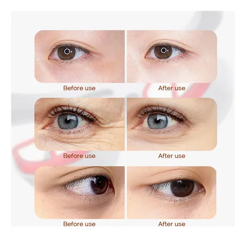 Masajeador De Ojos Light Circles, 3 Bolsas, Remove Gear, Col