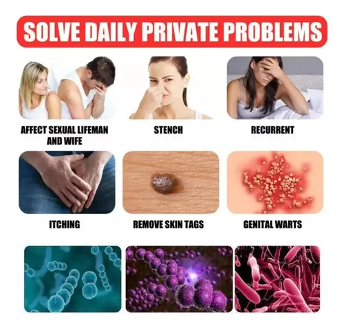 Cc 3uds*pomada Para Eliminar Las Verrugas Del Herpes
