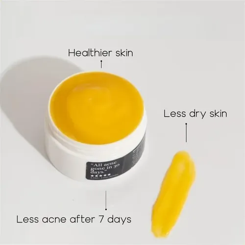Acné De Norse Organics