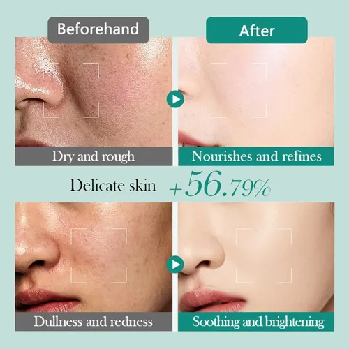 Set 6 En 1 Cuidado Facial Skincare Acido Hialuronico Bioaqua