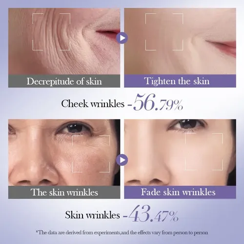 Kit Combo 6 Piezas Skincare Bioaqua Retinol Vitamina A