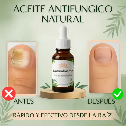 2×1 Aceite Antihongos Pies Manos Uñas 30ml Naturalmente