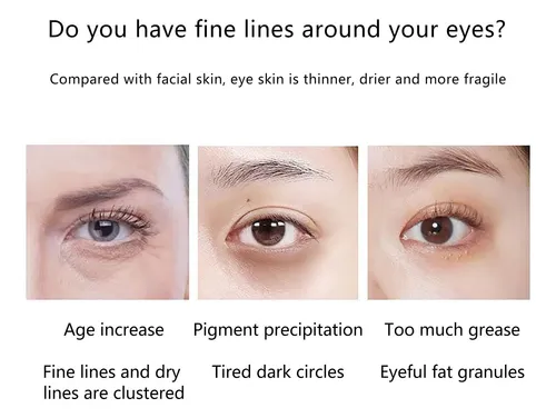 Crema Hidratante Reafirmante Para Ojos Con Retinoato Madura Día/noche
