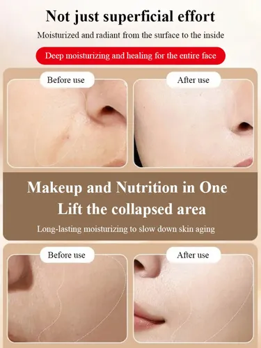 Niacinamida Blanqueadora 30g, Pack De 1/2/3, Cuidado Facial