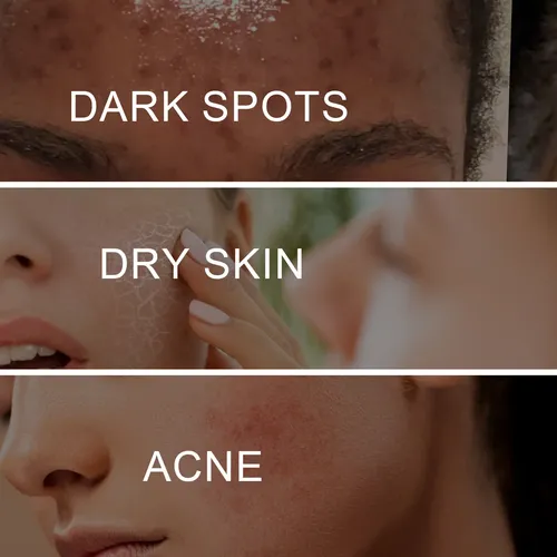 Crema Iluminadora Ouhoe Para Manchas Oscuras Y Piel Opaca