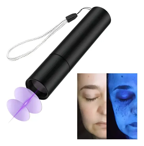 Luz De Wood Portátil Facial Usb