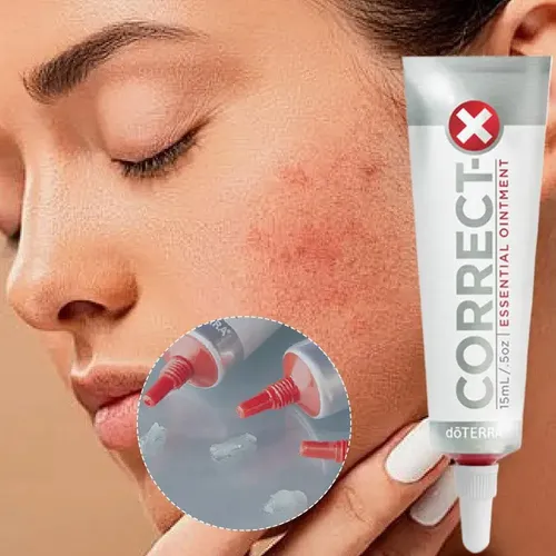 Crema Reparadora De 15 Ml, Alivia Las Alergias, Calma La Pie