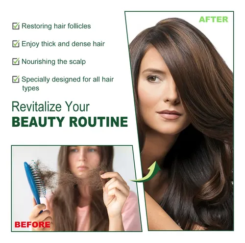 Aceite Capilar De Romero Eelhoe Para Cabello Fuerte Y Grueso