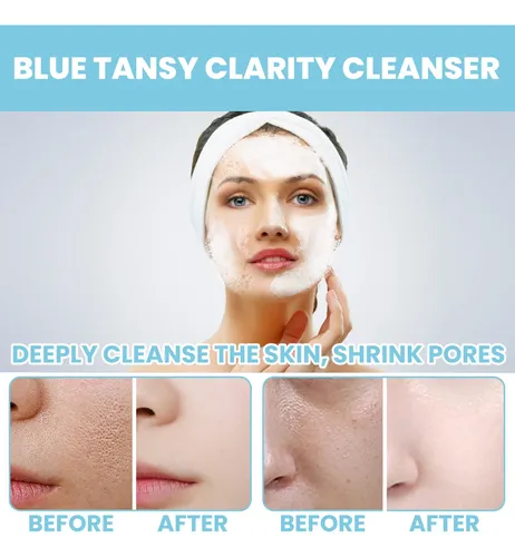 Lh Eelhoe Blue Tansy Limpador Para Piel Oleosa