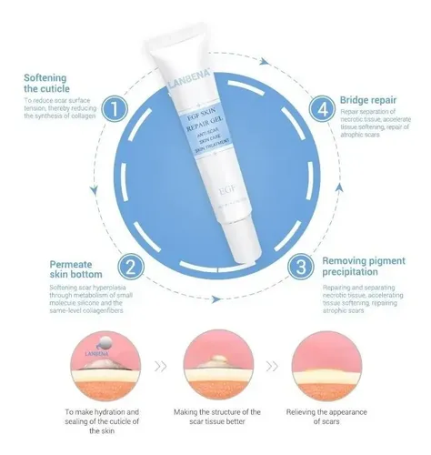 Crema Facial Blanqueador Acne Cicatriz No Cicatricure Import