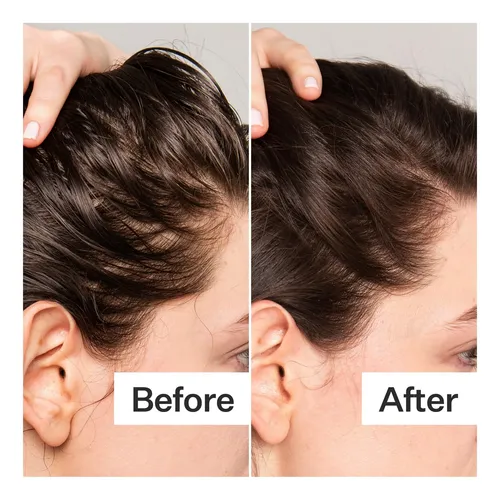 Exfoliante Para Cuero Cabelludo Act+ Acre Con Ácido Bha Proc
