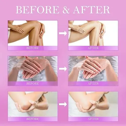 Crema Correctora Manchas Oscuras Lovood Niacinamida Colageno