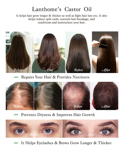 Sérum Potenciador De Cejas Oil Natural Para El Crecimiento D
