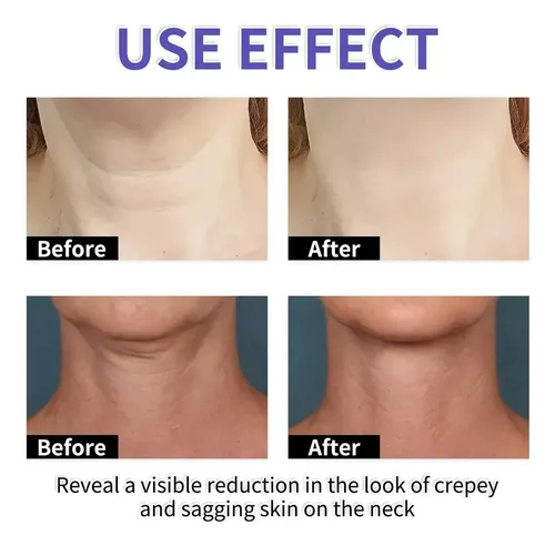 Crema Upgrade Pure Tighet & Lift Neck, 2 Unidades, Gopure N