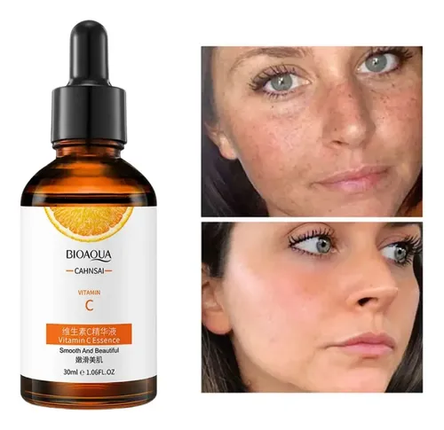 Suero Vitamina C Bioaqua Blanqueador Reparacion Cuidado Piel Tipo De Piel Todo Tipo De Piel