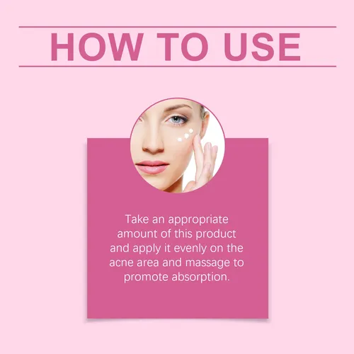 La Crema De Tratamiento Del Acné Facial South Moon Repara El