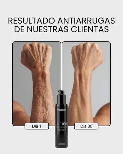 Crema Anti Age De Manos Y Brazos Altier Dermoelite