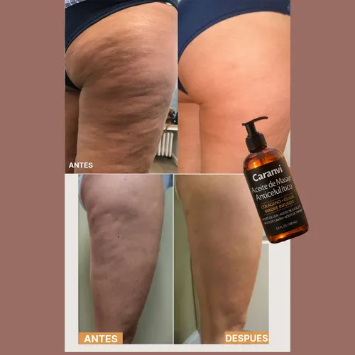Aceite Anticelulitis Masajeador De Spa (x2)